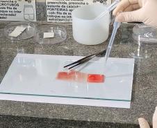 Produto desenvolvido na UEL determina o tipo sanguíneo em menos de dois minutos